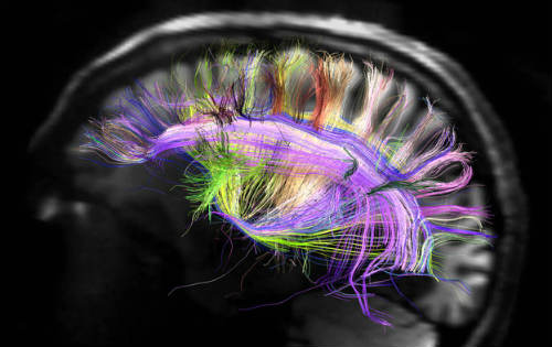 структура мозга человека